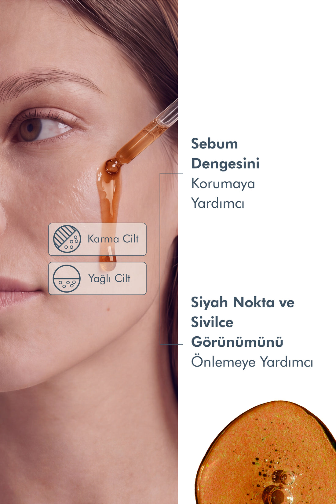 Gözenek, Sivilce ve Siyah Nokta Karşıtı Niacinamide Serum 30 Ml